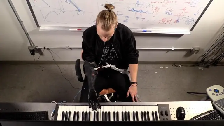 robot-musicians-robotic-prosthetic-hand.jpg